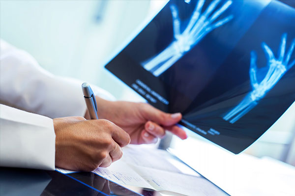 Radiographie